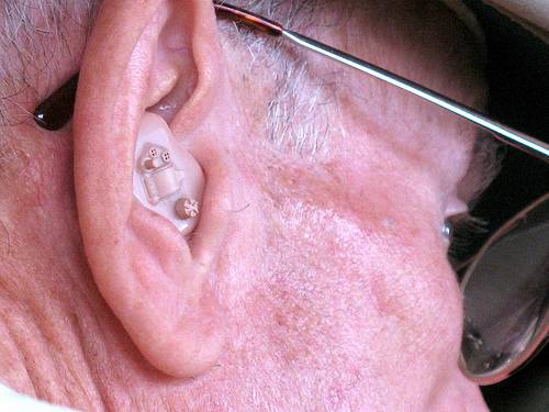 Hearing aids and dementia