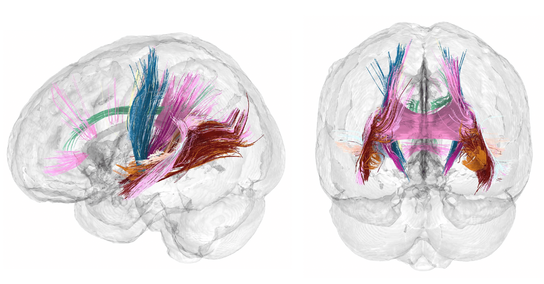 cerebro