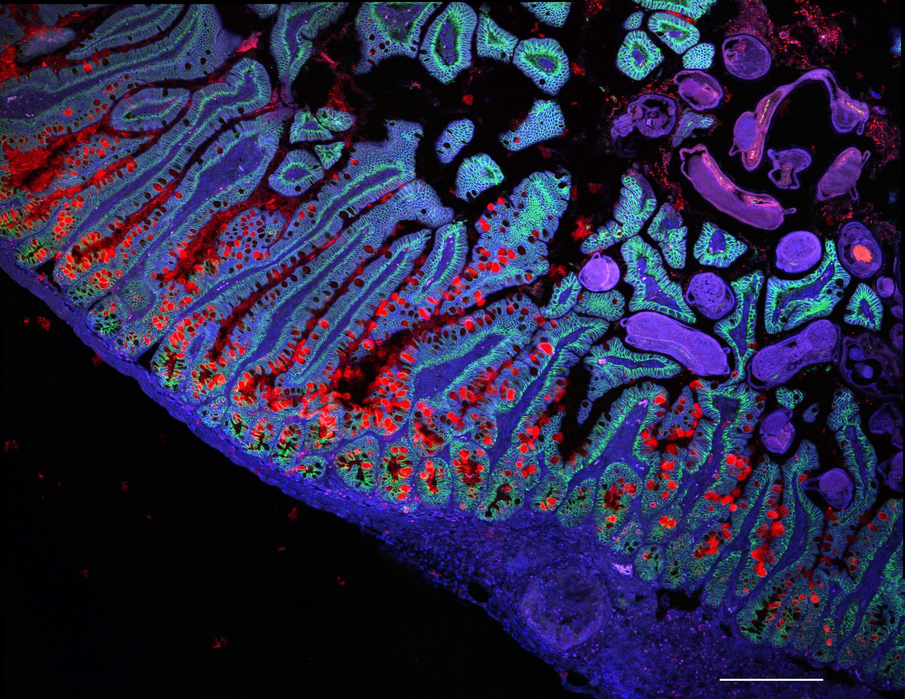 Intestino delgado humano