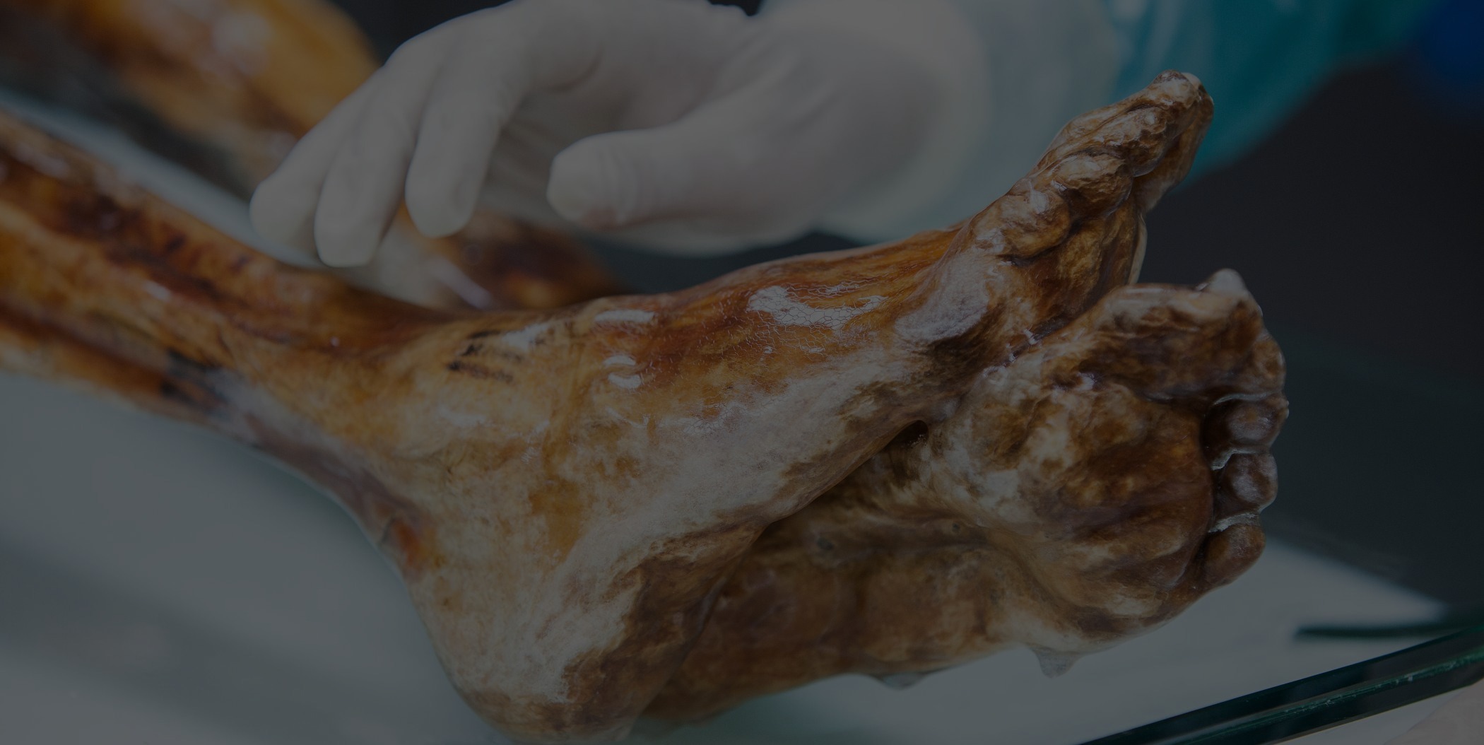 Ötzi