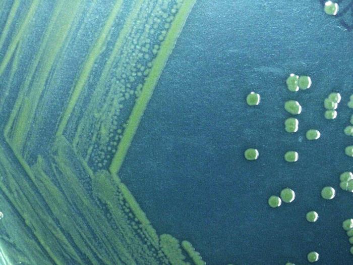 Shigella sonni