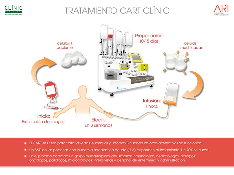 infografía leucemia CAR-T