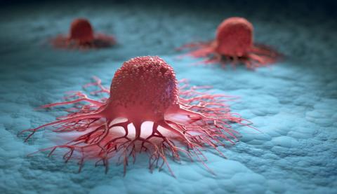 Ilustración 3D de un grupo de células cancerosas. / Adobe Stock