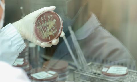 Gonorrhoea culture.