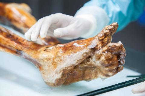 Otzi
