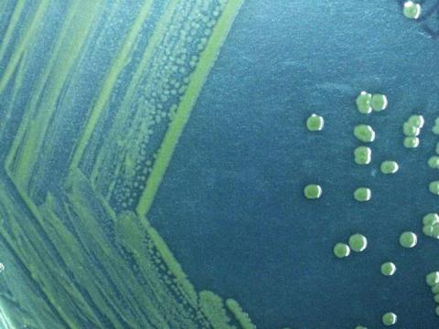 Shigella sonni