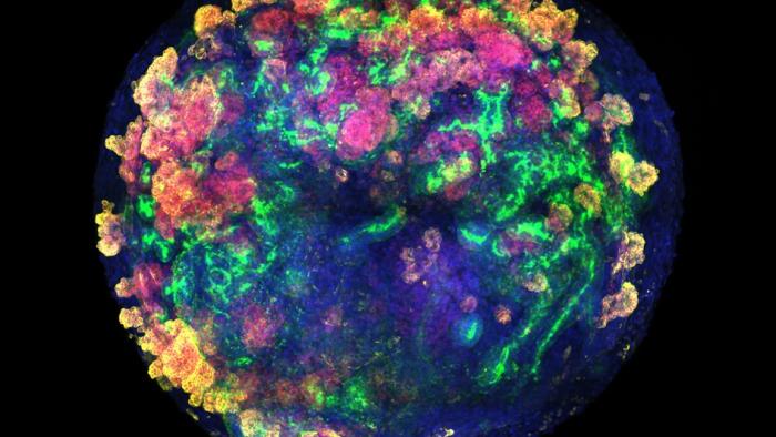 Trasplantan por primera vez en cerdos riñones porcinos modificados con organoides renales humanos Organoide