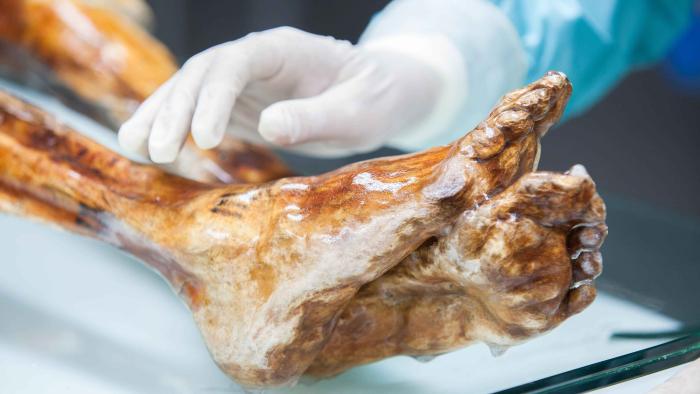 Otzi