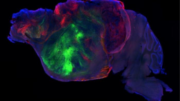 Organoides del cerebro humano forman redes neuronales en ratones Brain