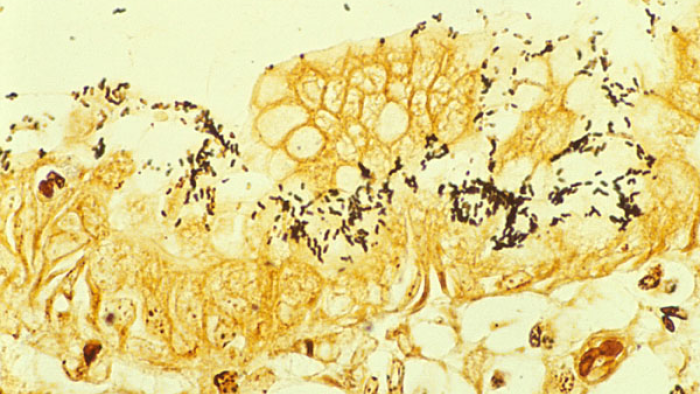 helicobacter pylori